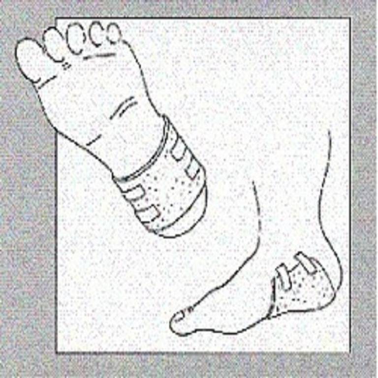 LIGASANO MEDIC PUR 15X10CM20PZ
